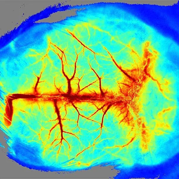 LSCI ZW Laser Speckle Contrast Imaging System